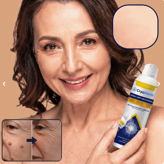 CryoDerm™ Spray – poista sitkeät syylät ja saat sileämmän ihon jo 7 päivässä